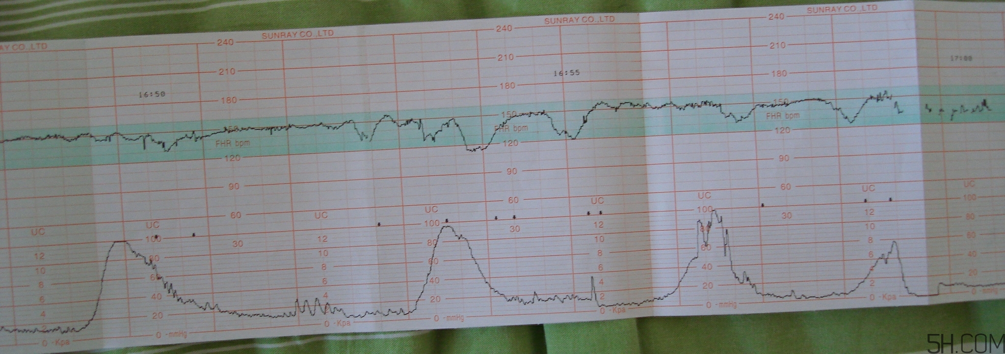 為什么要做胎心監(jiān)護(hù)？孕婦做胎心監(jiān)護(hù)有什么用？
