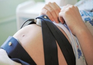 胎心監(jiān)護(hù)圖怎么看？胎心監(jiān)護(hù)多少錢？