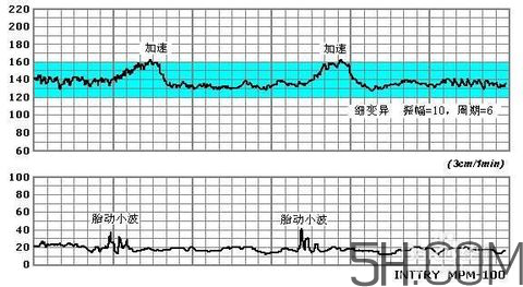 為什么要做胎心監(jiān)護(hù)？孕婦做胎心監(jiān)護(hù)有什么用？