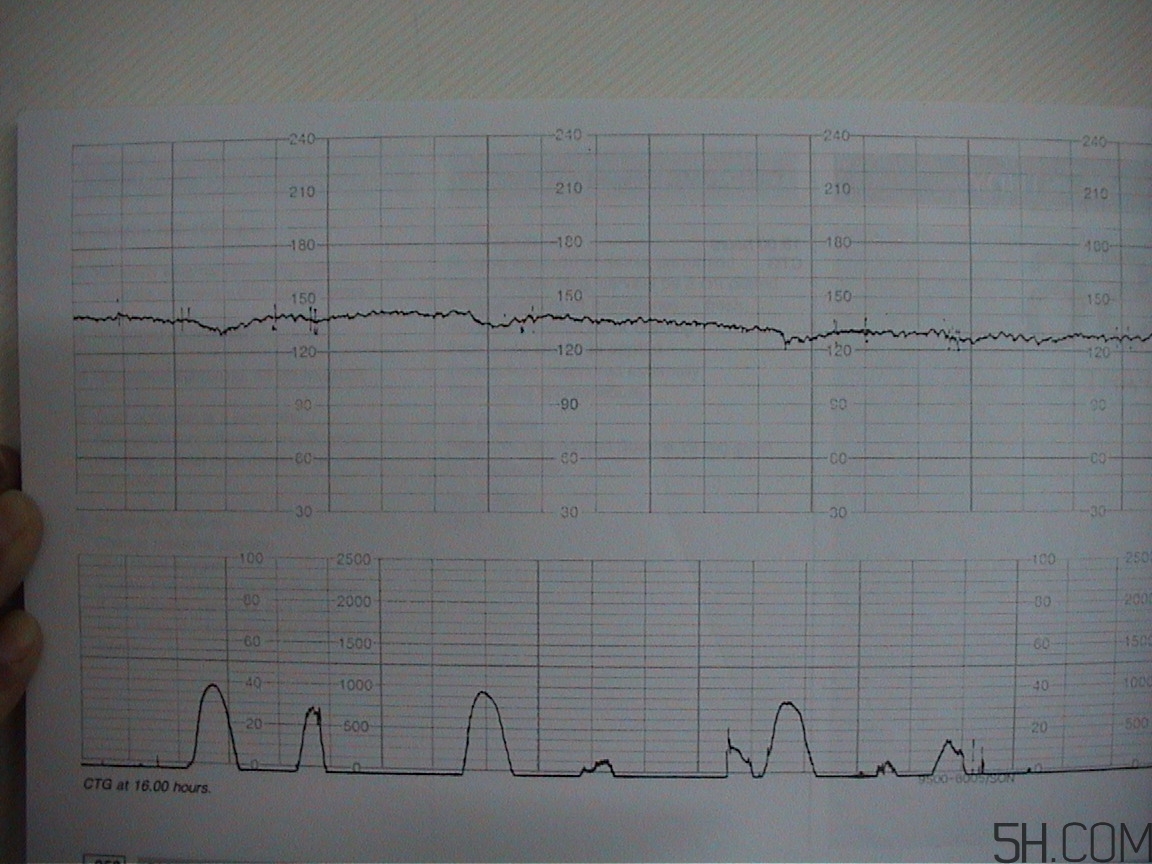 為什么要做胎心監(jiān)護(hù)？孕婦做胎心監(jiān)護(hù)有什么用？