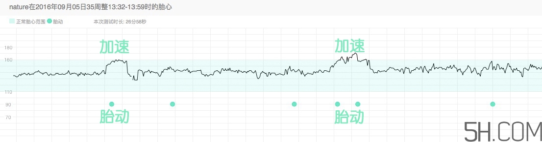 為什么要做胎心監(jiān)護(hù)？孕婦做胎心監(jiān)護(hù)有什么用？
