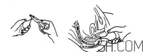 用開塞露會拉稀嗎？便秘用開塞露不管用怎么辦？