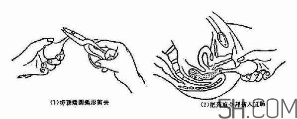 開塞露怎么用？開塞露用后多久會排便？