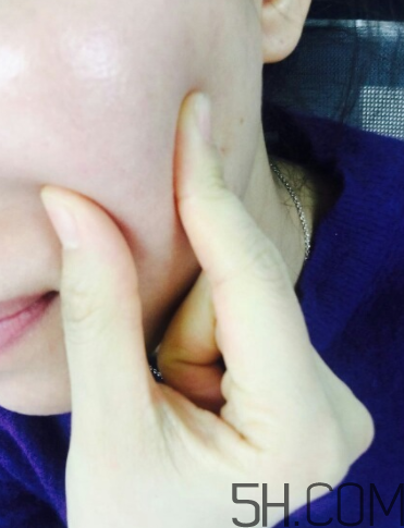 medicube潔柔收縮毛孔精華怎么樣_好用嗎 medicube潔柔收縮毛孔精華怎么樣_好用嗎