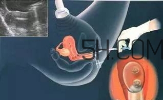 試管嬰兒有什么風險？試管嬰兒長大后的弊端