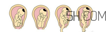 什么情況下需要剖腹產(chǎn) 剖腹產(chǎn)最全科普 什么情況下需要剖腹產(chǎn) 剖腹產(chǎn)最全科普