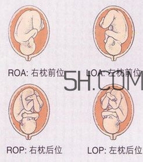 什么情況下需要剖腹產(chǎn) 剖腹產(chǎn)最全科普 什么情況下需要剖腹產(chǎn) 剖腹產(chǎn)最全科普