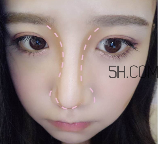 恒芳修容棒好用嗎？恒芳修容棒怎么樣？