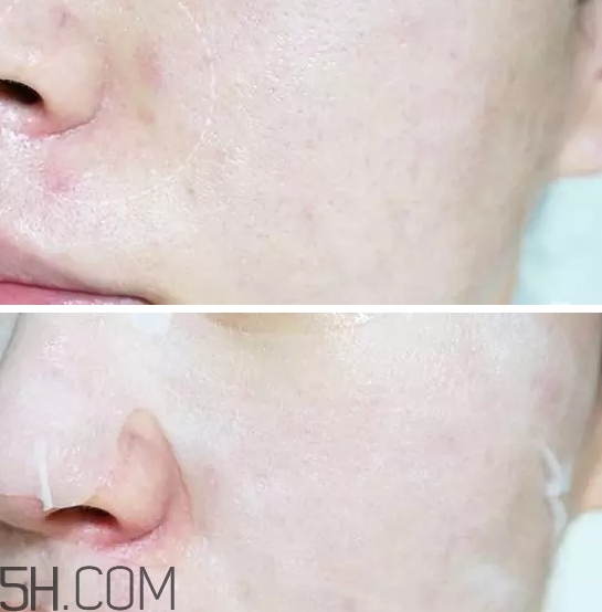 百元補(bǔ)水護(hù)膚品哪個(gè)牌子好？百元左右換季補(bǔ)水護(hù)膚品推薦