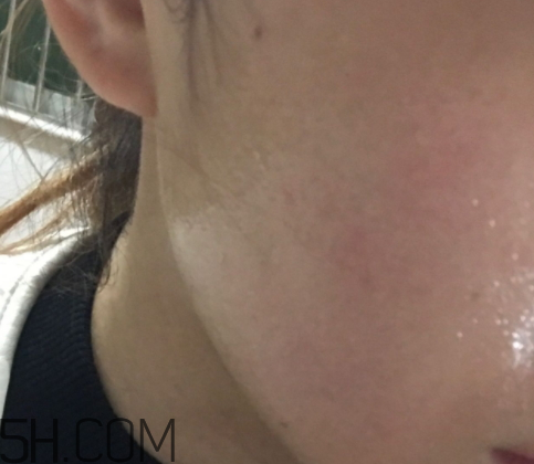 新生活國際玻尿酸補水面膜怎么樣？多少錢？