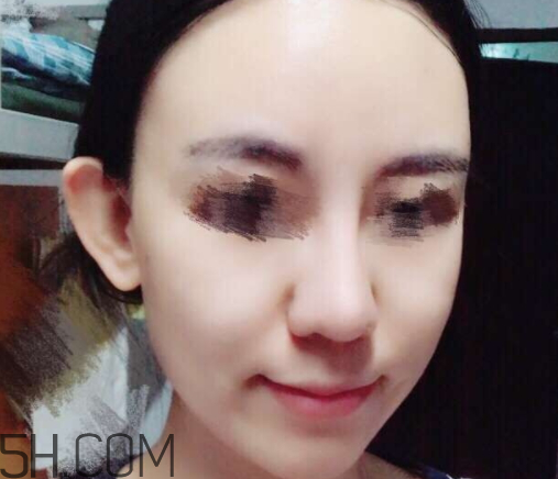 京潤(rùn)珍珠玻尿酸面膜怎么樣？多少錢？