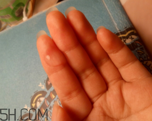 蘭芙玻尿酸原液怎么樣 蘭芙玻尿酸原液多少錢 蘭芙玻尿酸原液怎么樣 蘭芙玻尿酸原液多少錢