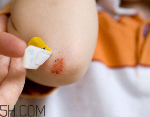 創(chuàng)可貼有消炎作用嗎？一張創(chuàng)可貼能用多長時間