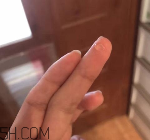 倍舒痕可以去痘印嗎？倍舒痕能涂在痘痘上嗎？