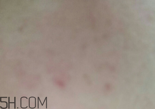 aox suaox祛痘原液怎么樣？多少錢？