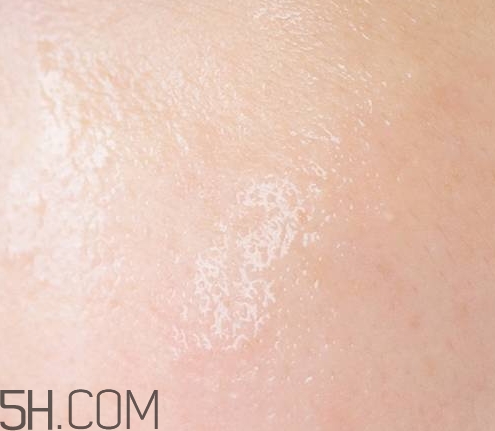 esthe dew爽膚水哪個顏色好？esthe dew化妝水不同顏色區(qū)別