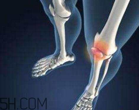 關(guān)節(jié)炎打封閉針好嗎？關(guān)節(jié)炎打封閉針有副作用嗎？