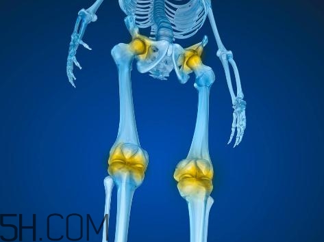 關節(jié)炎積液什么癥狀？關節(jié)炎積水怎么治療？