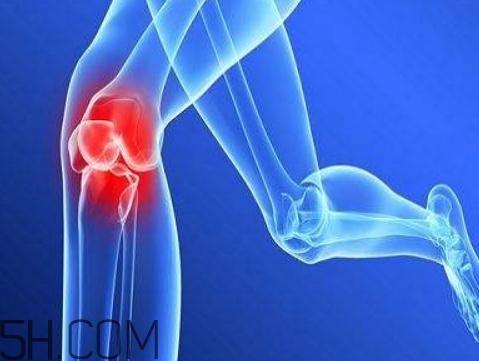 關(guān)節(jié)炎需要補鈣嗎？關(guān)節(jié)炎補鈣有用嗎？