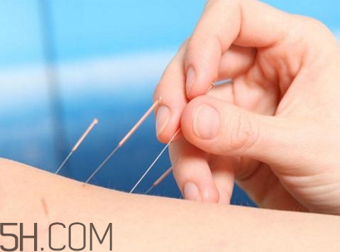 關(guān)節(jié)炎需要補鈣嗎？關(guān)節(jié)炎補鈣有用嗎？