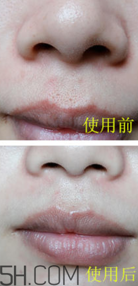 蘭蔻美膚修護(hù)精華乳怎么樣_好用嗎 蘭蔻美膚修護(hù)精華乳怎么樣_好用嗎