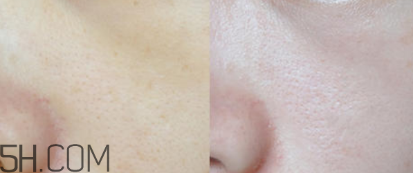 蘭蔻美膚修護(hù)精華乳怎么樣_好用嗎 蘭蔻美膚修護(hù)精華乳怎么樣_好用嗎