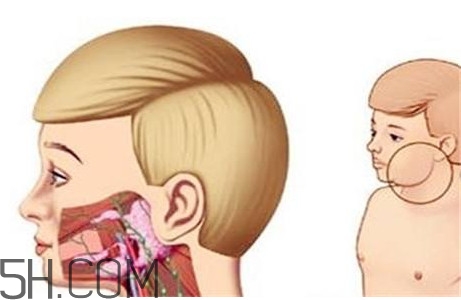 淋巴癌最嚴(yán)重時(shí)會(huì)成什么樣子？淋巴瘤能治好嗎