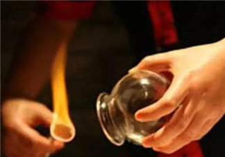 關(guān)節(jié)炎可以拔火罐嗎？關(guān)節(jié)炎拔罐管用嗎？