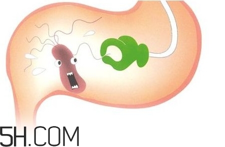 幽門螺桿菌會傳染嗎？幽門螺桿菌吃什么藥