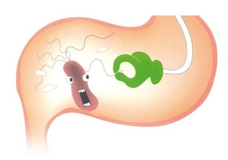 幽門螺桿菌會傳染嗎？幽門螺桿菌吃什么藥