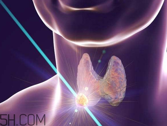 什么樣的甲狀腺結(jié)節(jié)要懷疑是癌？甲狀腺結(jié)節(jié)嚴重嗎