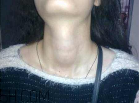 甲狀腺結(jié)節(jié)掛什么科？甲狀腺結(jié)節(jié)可以懷孕嗎