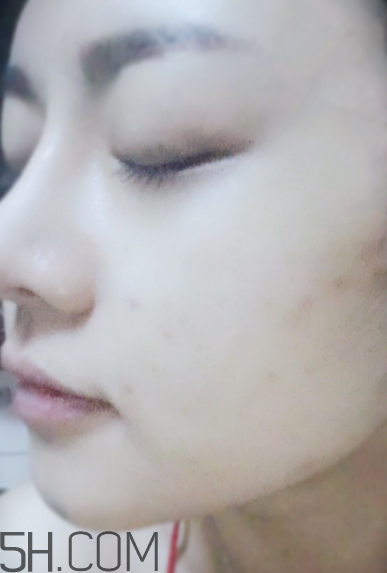 菲洛嘉21天美白精華多少錢(qián)_專柜價(jià)格