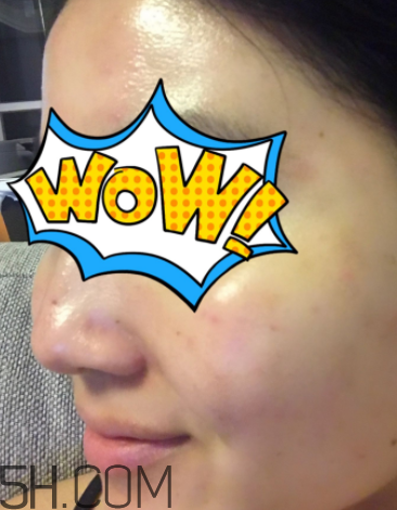 菲洛嘉21天美白精華多少錢(qián)_專柜價(jià)格