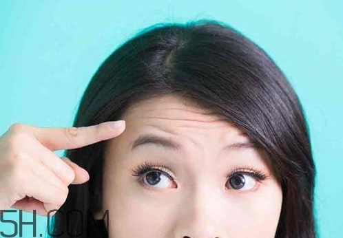 抬頭紋可以用針灸治療嗎_怎么預(yù)防抬頭紋 抬頭紋可以用針灸治療嗎_怎么預(yù)防抬頭紋