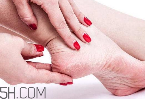 早上下床腳后跟痛是怎么回事_怎么辦 早上下床腳后跟痛是怎么回事_怎么辦