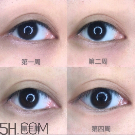 黑眼圈怎么去除既簡單有容易 看類型與程度 黑眼圈怎么去除既簡單有容易 看類型與程度