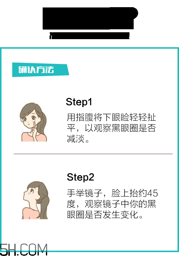 黑眼圈怎么去除既簡單有容易 看類型與程度 黑眼圈怎么去除既簡單有容易 看類型與程度