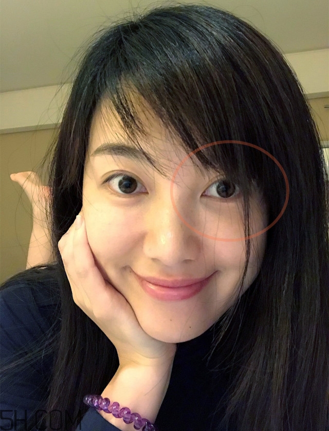 黑眼圈怎么去除既簡單有容易 看類型與程度 黑眼圈怎么去除既簡單有容易 看類型與程度