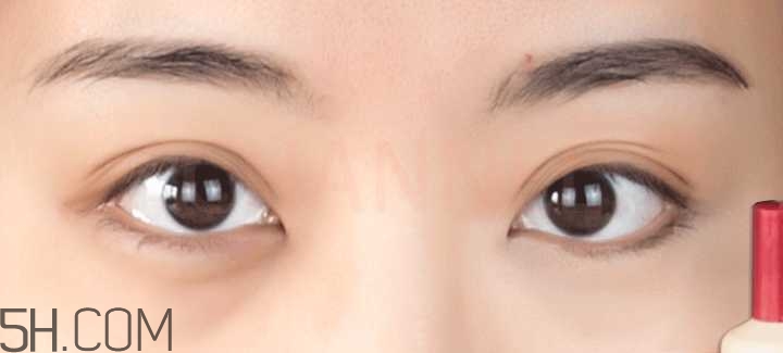 黑眼圈怎么去除既簡單有容易 看類型與程度 黑眼圈怎么去除既簡單有容易 看類型與程度