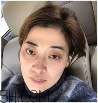 黑眼圈怎么去除既簡單有容易 看類型與程度 黑眼圈怎么去除既簡單有容易 看類型與程度