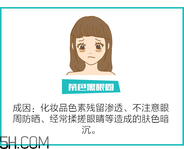 黑眼圈怎么去除既簡單有容易 看類型與程度 黑眼圈怎么去除既簡單有容易 看類型與程度