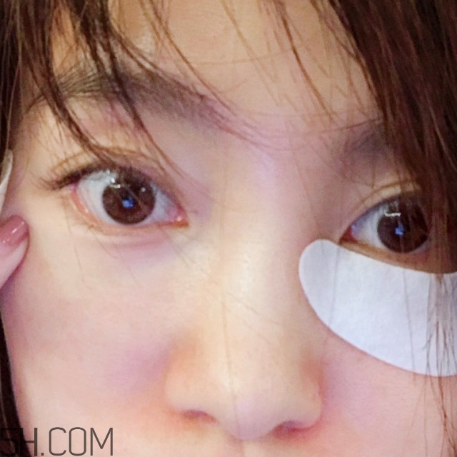 黑眼圈怎么去除既簡單有容易 看類型與程度 黑眼圈怎么去除既簡單有容易 看類型與程度