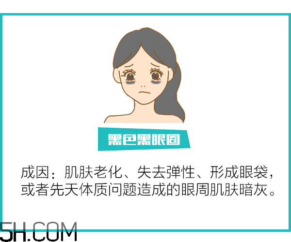 黑眼圈怎么去除既簡單有容易 看類型與程度 黑眼圈怎么去除既簡單有容易 看類型與程度