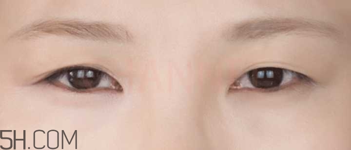 黑眼圈怎么去除既簡單有容易 看類型與程度 黑眼圈怎么去除既簡單有容易 看類型與程度