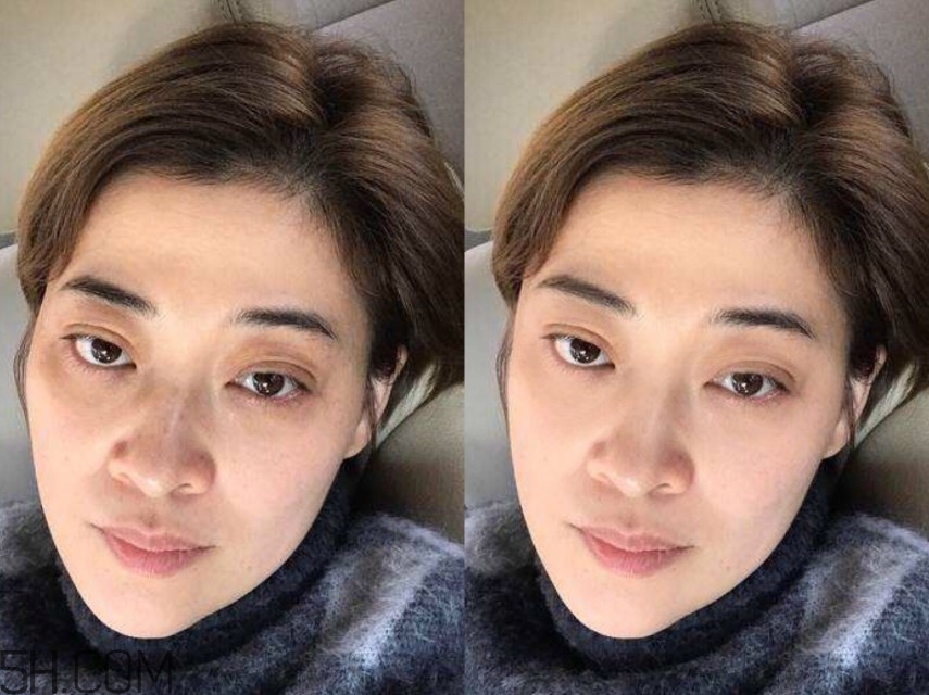 黑眼圈怎么去除既簡單有容易 看類型與程度 黑眼圈怎么去除既簡單有容易 看類型與程度