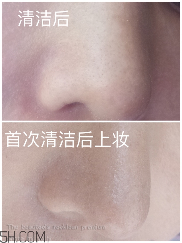 the beautools毛孔清潔器好用嗎_24k黑頭鏟評測 the beautools毛孔清潔器好用嗎_24k黑頭鏟評測