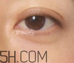 伊詩蘭頓眼膜好用嗎？伊詩蘭頓眼膜怎么用