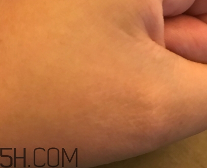 芳丹薄羅眼膜怎么用？芳丹薄羅眼膜要洗嗎