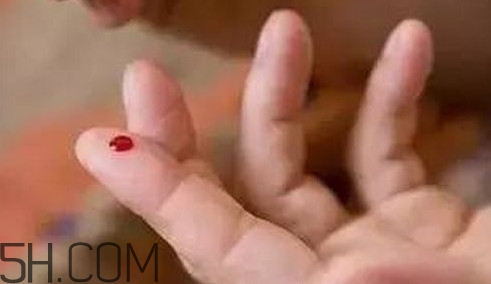 放血療法適合任何人嗎？放血療法是如何退出歷史舞臺的